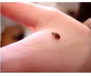 A bed bug on a hand — roughly 5mm long, about the size of an apple seed. Close-up of a bed bug on a person's hand showing its size relative to human skin